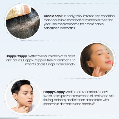 Boldog Cappy Korpásodás Elleni Sampon, Anti-Seborrheás Dermatitis Sampon, a Cink-pirition-0,95% - A, biztonságosan Használható az Arc,